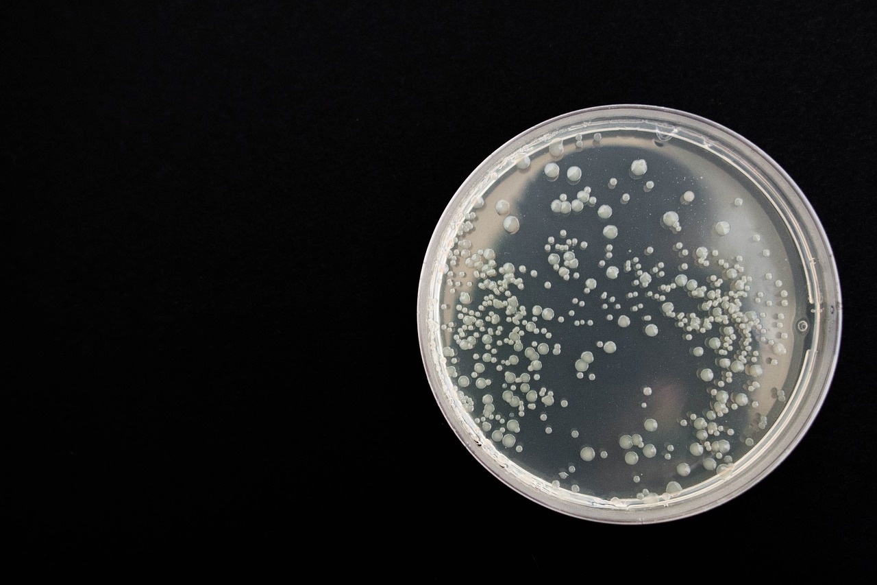 Legionella niebezpieczna bakteria w środowisku wodnym